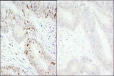 Immunohistochemistry: MCM2 [p Ser41] Antibody [NB100-2569]